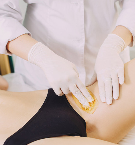 CERETTA INGUINE PARZIALE