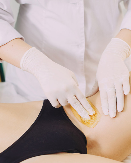 CERETTA INGUINE PARZIALE